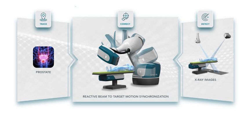 Cyber-Knife-for-Prostate-Cancer CyberKnife for Prostate Cancer